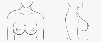 brasize #breastshape #shape #fit #bras #bodypositive #sizeguide #bras