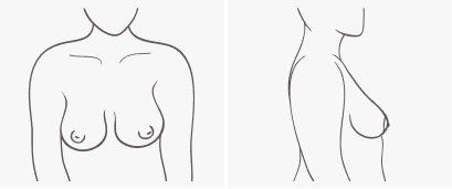 Breast Shape Bra Fit